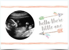 Load image into Gallery viewer, Ultrasound Photo Magnets (Many Options)