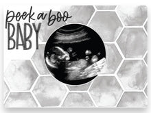 Load image into Gallery viewer, Ultrasound Photo Magnets (Many Options)