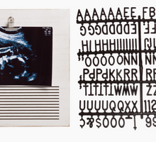 Load image into Gallery viewer, Sonogram Letterboard Frame