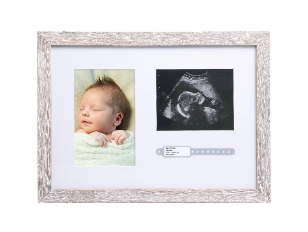 Hospital Bracelet & Sonogram Photo Frame