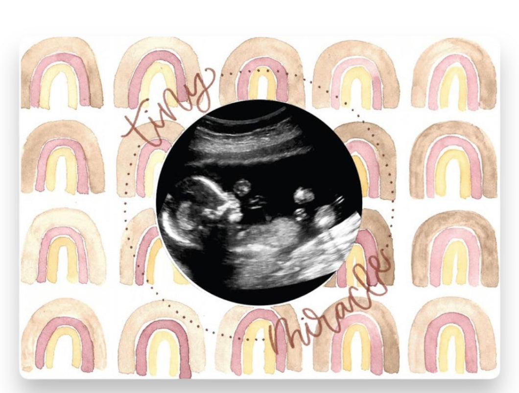 Magnetic Ultrasound Photo Frame- Rainbow Baby
